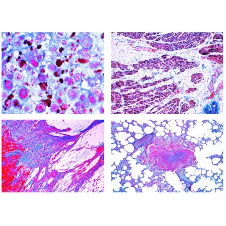 Lieder Histología Patológica para medicina veterinaria, 22 diapositivas